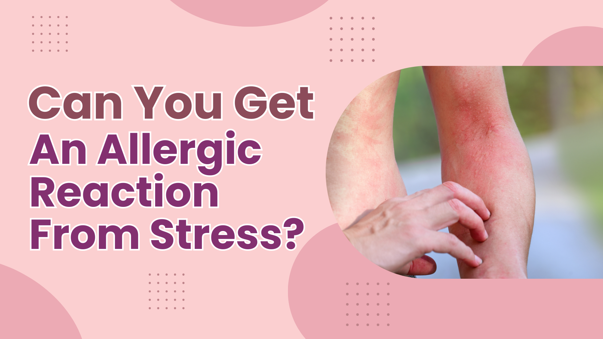 Can You Get An Allergic Reaction From Stress?