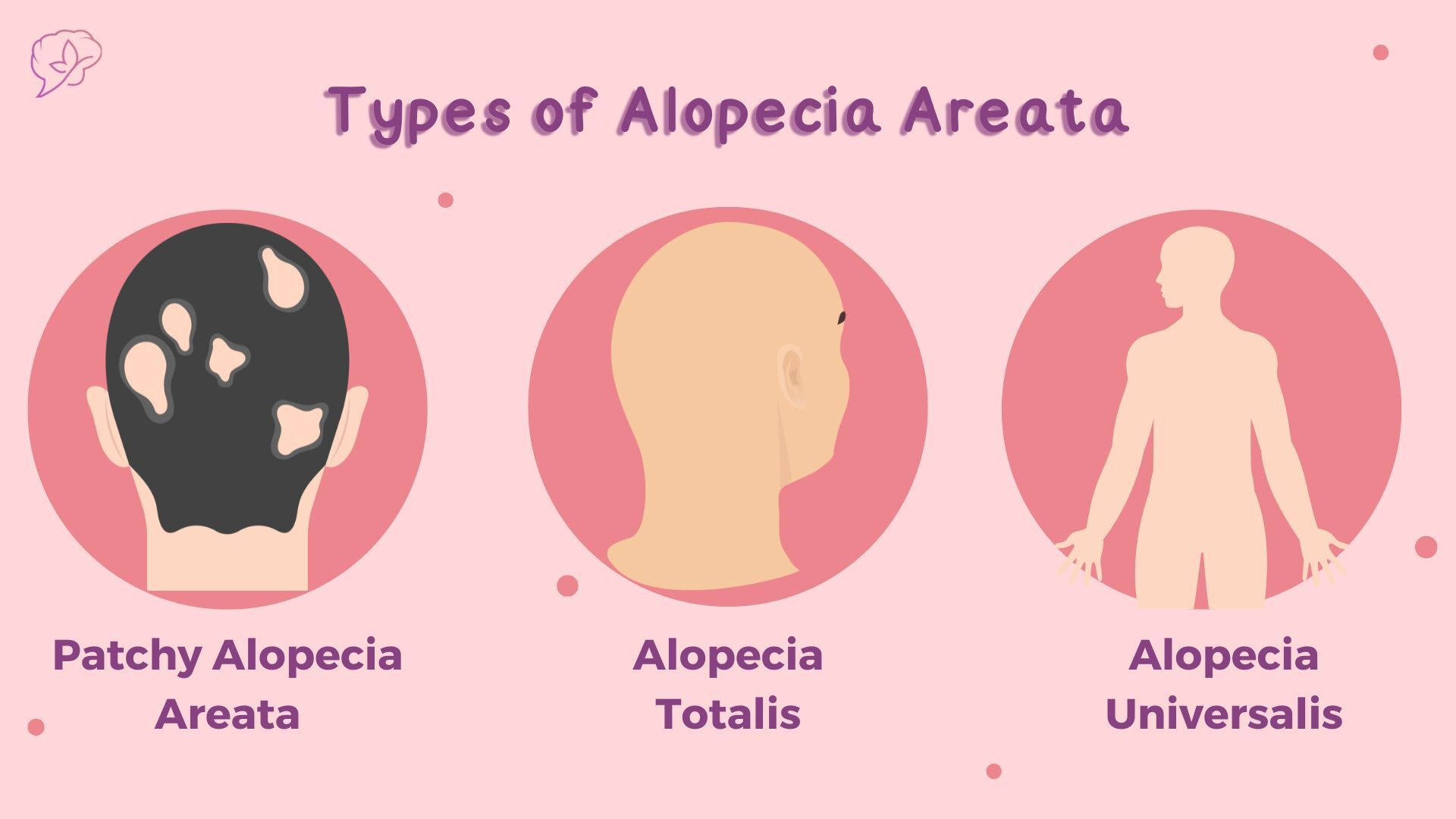 Types of Alopecia Areata